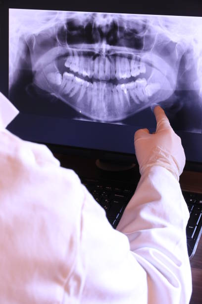 Best Emergency Dental Surgery in Aust, IN